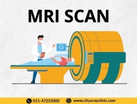 MRI Scan Near Me In Delhi NCR At Affordable price , New Delhi, India
