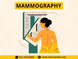 Best Diagnostic Centre For Mammography scan , New Delhi, India