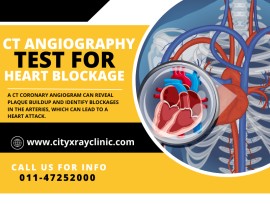 CT Coronary Angiography Test Near Me In Delhi NCR, New Delhi, India